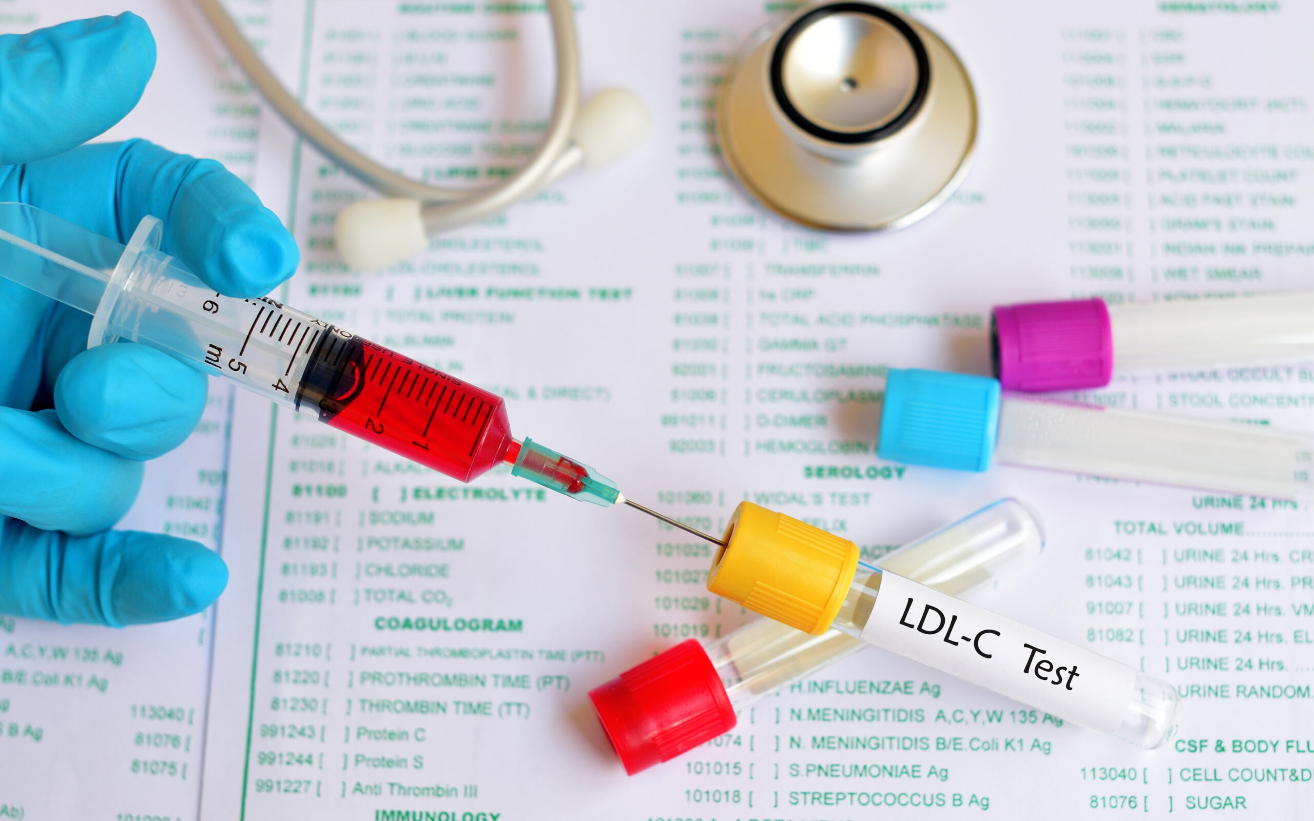 Cholesterol ratio calculator: what it is, why it matters, and how to use it