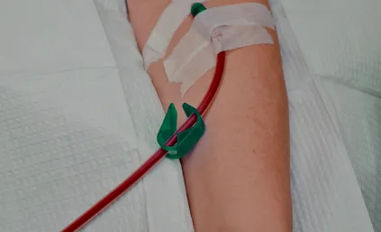 An IV is attached to the hand for EBOO therapy