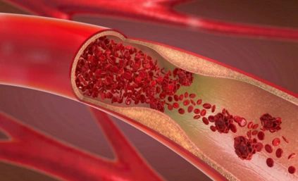 Blood flow pic for the IV Chelation Therapy at The Remedy Room