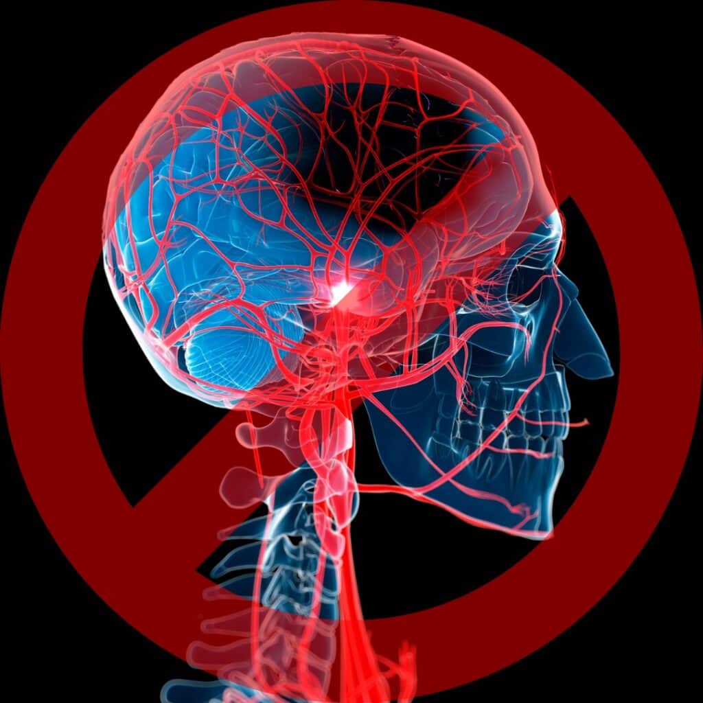 Prevent Stroke